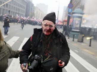 Tomasz Gutry, fotoreporter „Tygodnika Solidarność”, ucierpiał podczas wczorajszych ulicznych zamieszek w Warszawie